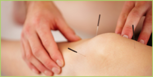 acupunctureen1banner