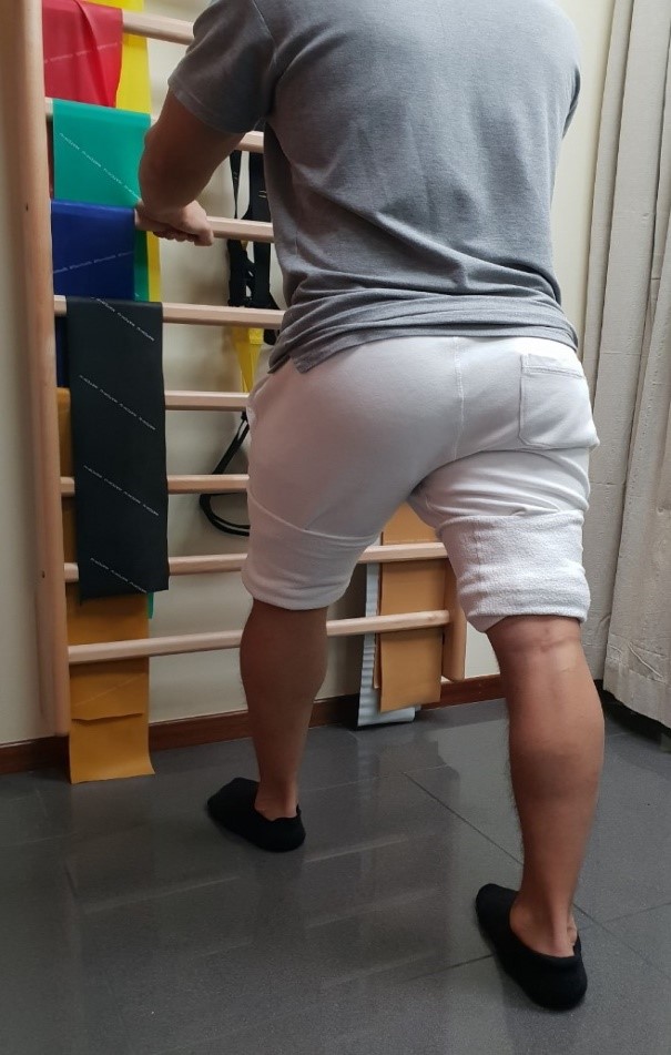 Πελματιαία Απονευρωσίτιδα: Η πιο Συχνή Πάθηση του Ποδιού