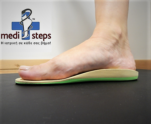 Το νεύρωμα Morton