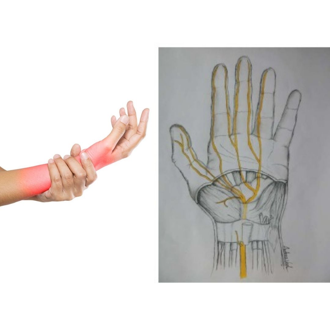 Η χρήση της τεχνολογίας συνδέεται με το Σύνδρομο Καρπιαίου Σωλήνα