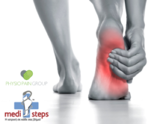 Πελματιαία Απονευρωσίτιδα